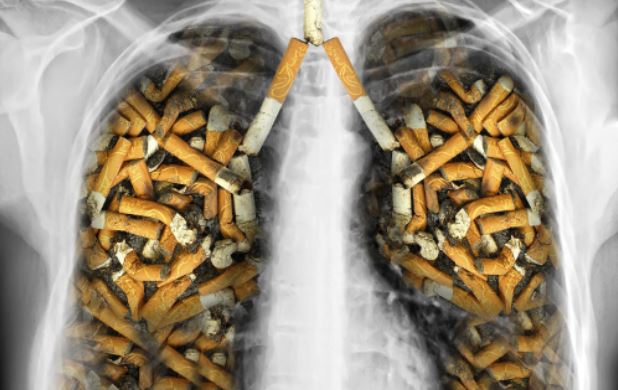 El cáncer de pulmón es, sin lugar a dudas, una de las consecuencias más conocidas y temidas del cigarrillo. 