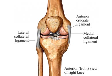 La lesión de los ligamentos laterales es típica de giros bruscos con el pie apoyado o de traumatismos.
