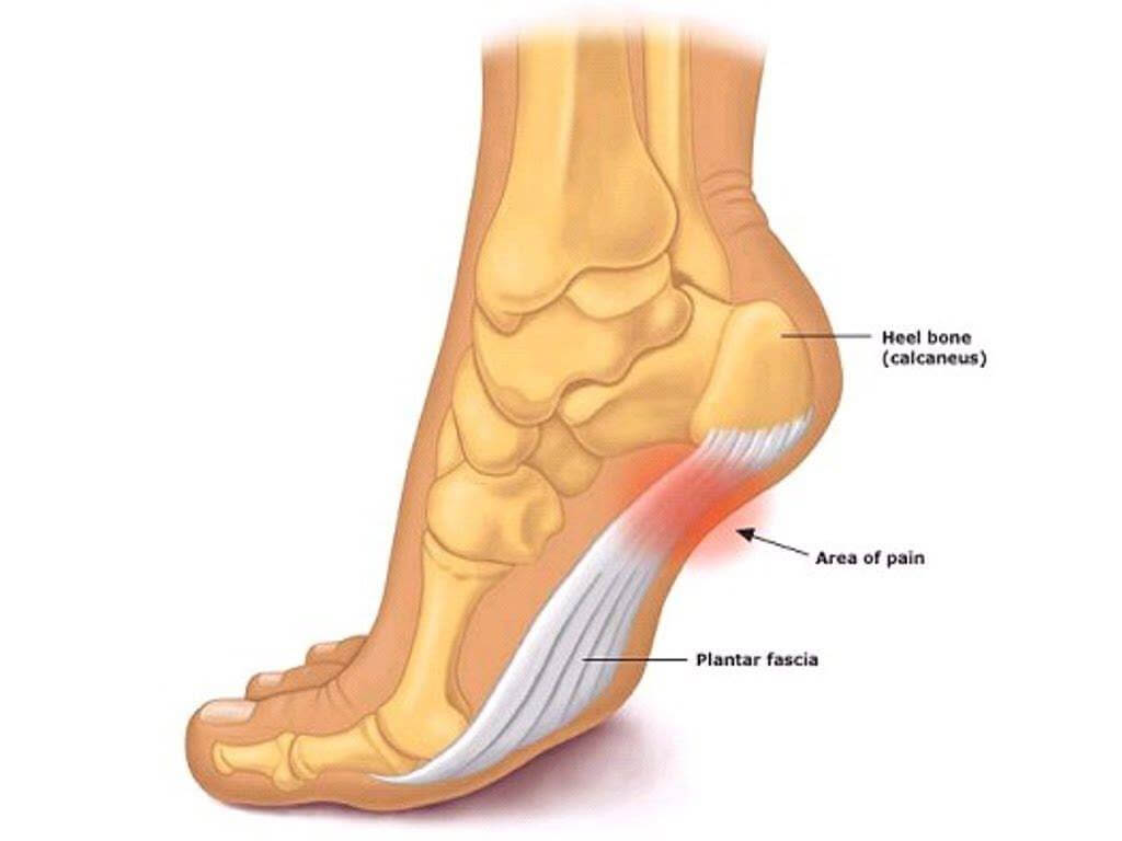 La fascia plantar es el tejido que recubre la parte inferior del pie.