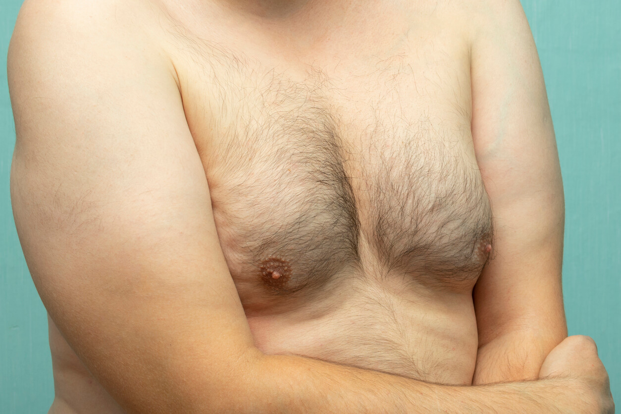 Los senos masculinos generan un problema de autoestima en muchos hombres