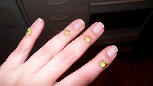 gel-aloe-vera