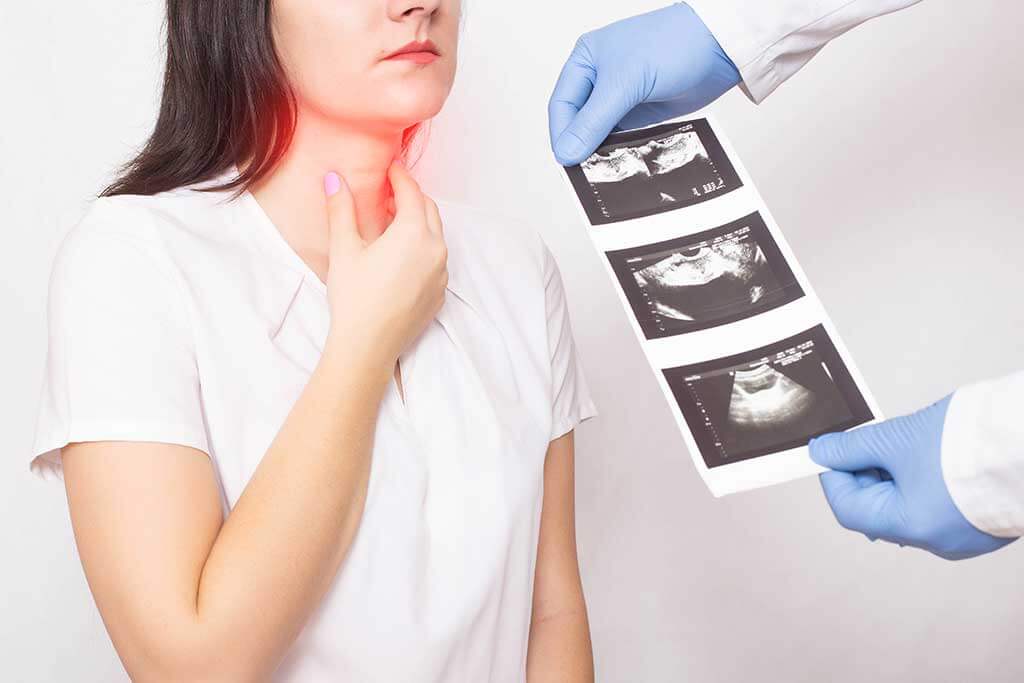 Cómo sobrellevar el hipotiroidismo: 4 consejos