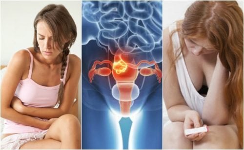 Miomas uterinos: causas y síntomas principales