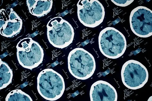Imágenes de diagnostico medico