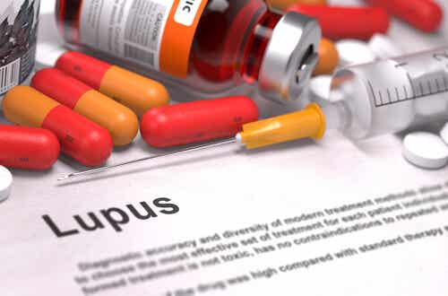 Síntomas, diagnóstico y tratamiento del lupus