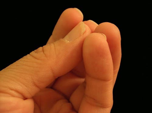estado de salud a través del color de las uñas