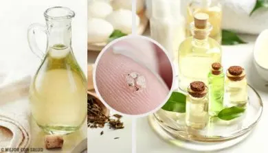 Cómo eliminar las verrugas de forma natural