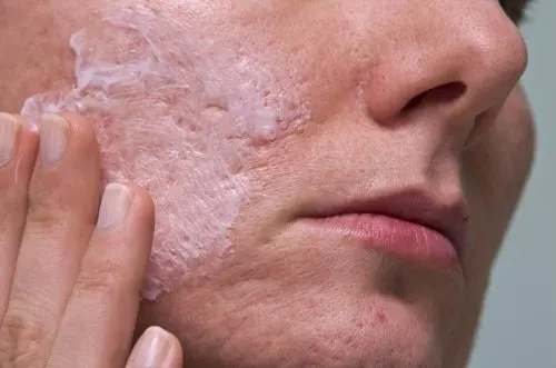 Mascarilla de yogur para el acné