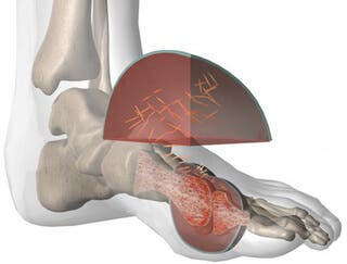 ¿Necesitas reducir tu nivel de ácido úrico?