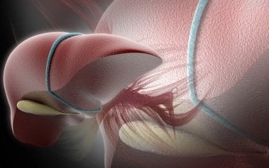 Dieta recomendada para el hígado graso