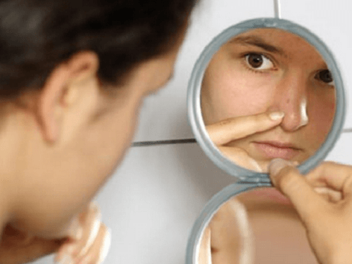 4 remedios naturales contra el acné