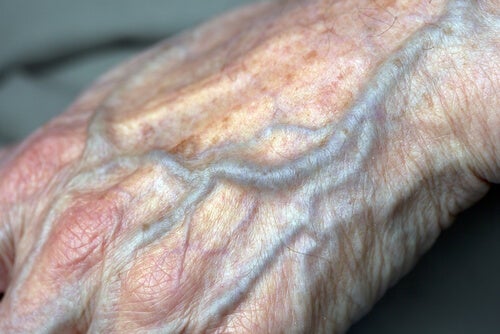 Contando insectos perturbación grueso Cómo mejorar la circulación en las manos? - Mejor con Salud