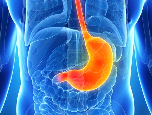 ¿Qué es la gastritis? Claves para aliviarla
