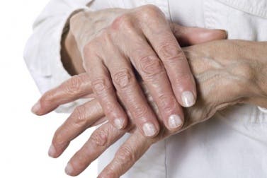 Remedios naturales para las grietas en las manos