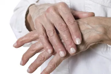 Remedios naturales para las grietas en las manos