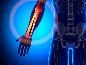 Los 10 mejores alimentos para los huesos