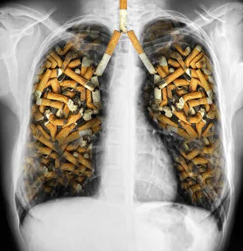 El hábito de fumar puede causar enfermedades pulmonares