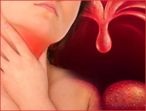 Remedios naturales para la faringitis