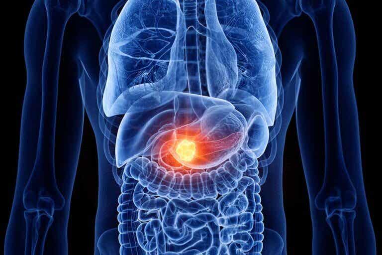 Pancreatitis: ¿cuál es la dieta más adecuada?