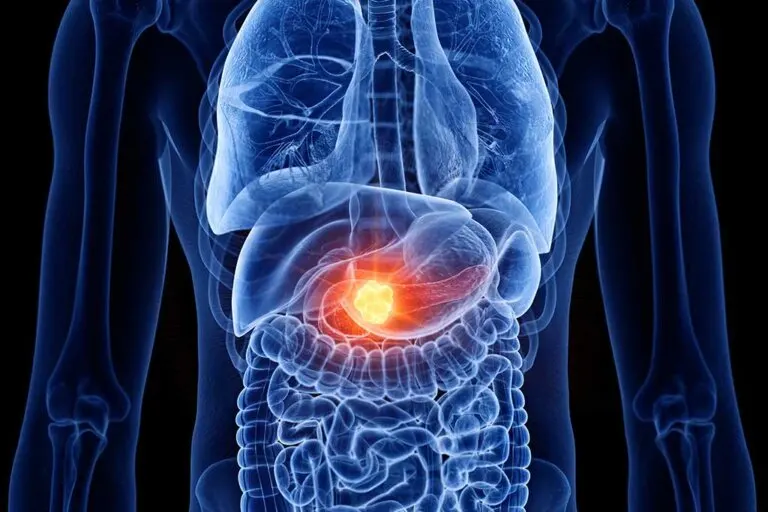 Pancreatitis: ¿cuál es la dieta más adecuada?
