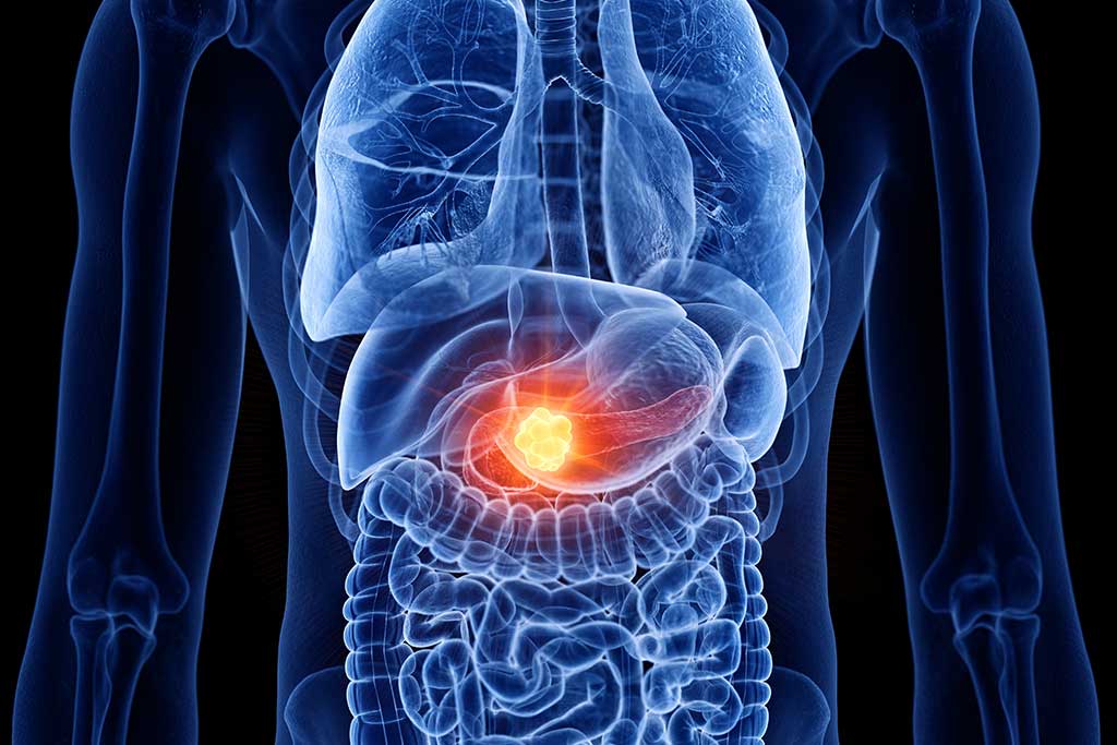 pancreas diéta fogyás 60 nap