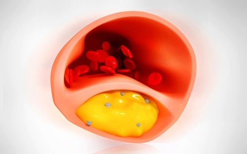 Combate naturalmente la aterosclerosis