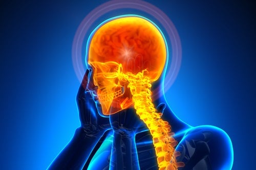 Causas y remedios para las cefaleas