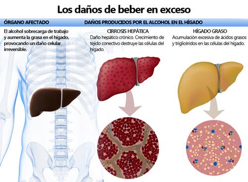 Efectos que tiene el alcohol en el organismo