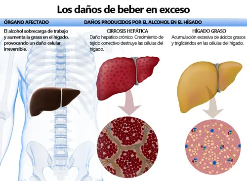 Efectos que tiene el alcohol en el organismo