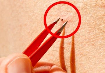 Garrapatas: Un peligro frecuente para humanos y animales