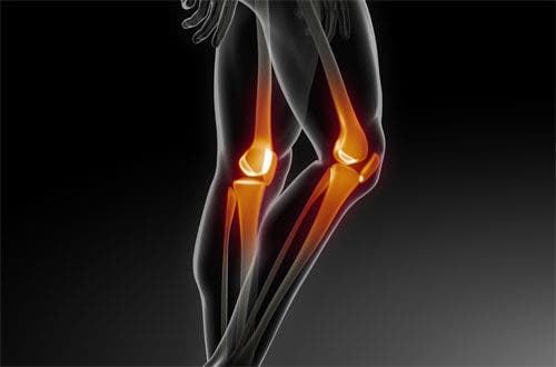 Cómo prevenir problemas óseos