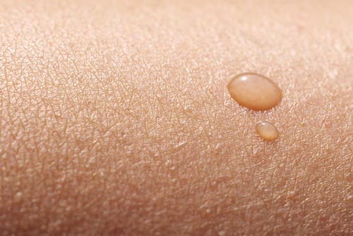 Con la depilación del vello genital la piel sufre