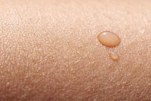 Conociendo qué dice tu piel de tu salud: piel reseca