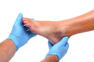 Hinchazón de tobillos y pies, causas y prevención