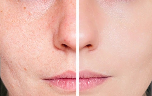 5 señales de alergia a los cosméticos que debes conocer