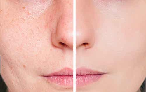 5 señales de alergia a los cosméticos que debes conocer