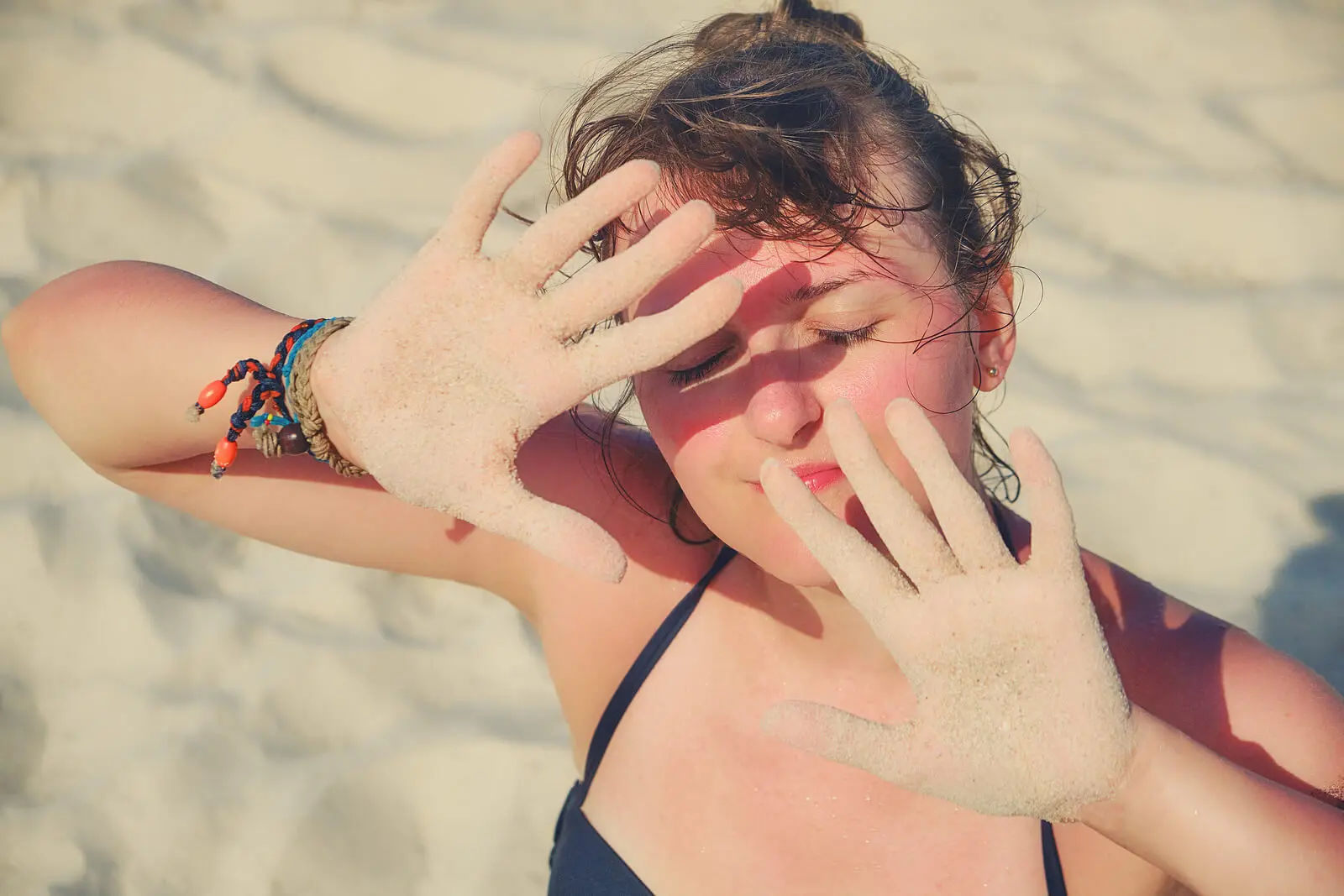 La falta de protección es una de las posibles causas de alergia al sol.