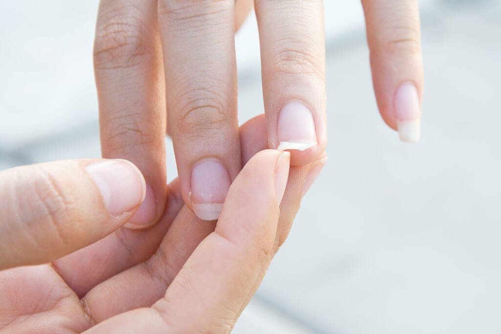 evitar que las uñas se quiebren