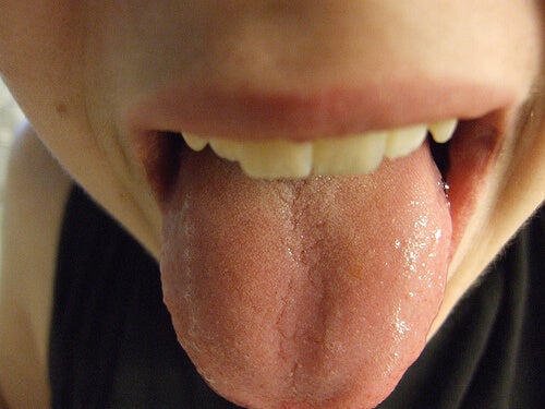 Señales de salud o enfermedad en la lengua