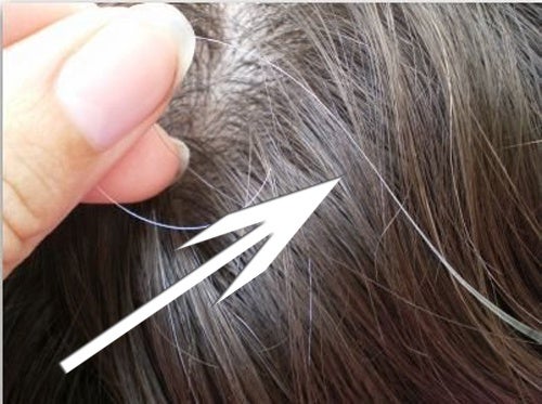 Prematuro ingrigimento dei capelli come conseguenza dello stress.