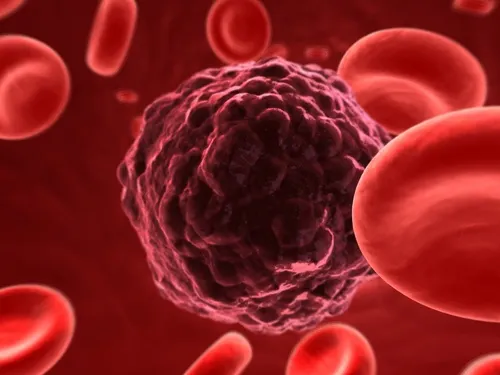 Celulas cancerosas