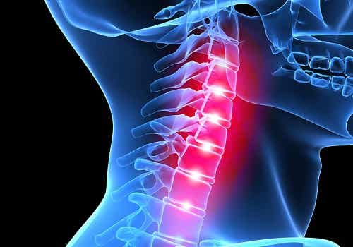 Dolencias en la parte cervical superior de columna vertebral
