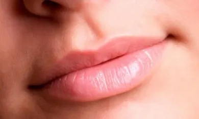 Labios agrietados: posibles causas y cuidados