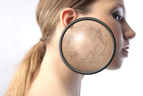 Usos de la vainilla para mejorar la piel y el cabello: humectar la piel seca