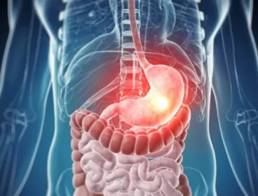 ¿Cuáles son las principales intolerancias alimenticias?