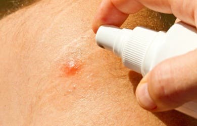 Los mejores repelentes caseros para mosquitos