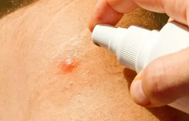 Los mejores repelentes caseros para mosquitos