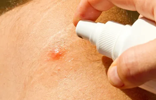 Repelentes de mosquitos