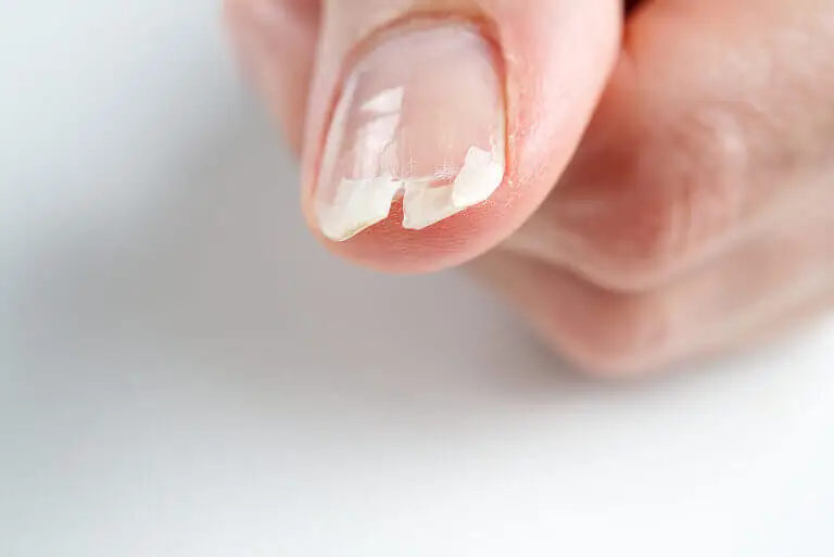 Características de las uñas que dan pistas acerca del estado de salud