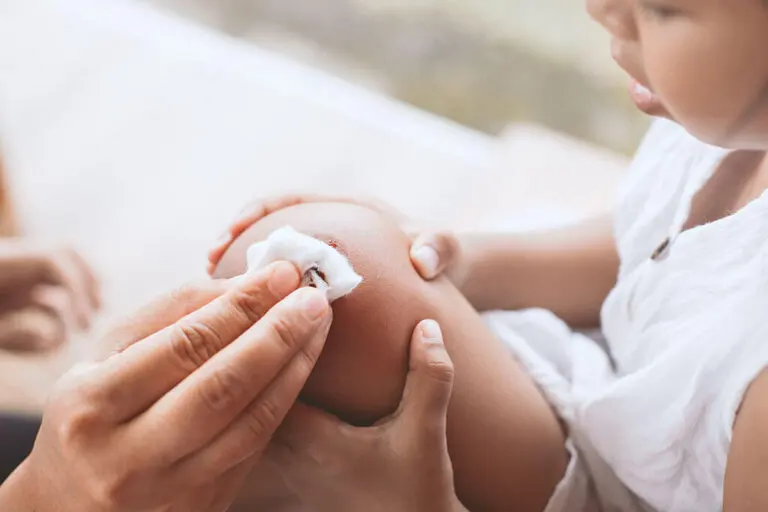 Cómo puedes desinfectar una herida